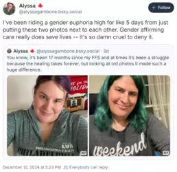 crazychadtranny.png