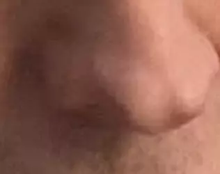 knose knotch.png