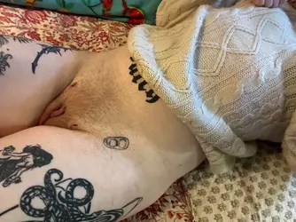 vaginoplasty-mgh-1-week-post-op-v0-t8h8oq89k98e1.webp