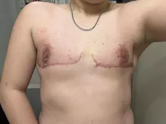howre-my-scars-looking-v0-dg2zjd25uh9e1.webp