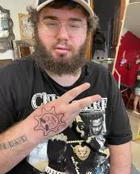 frank hassle arm.jpeg