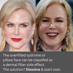 90-300x300.jpg