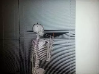 bone.jpg