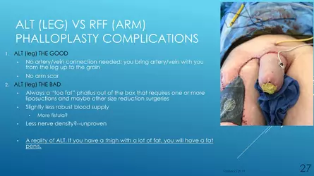 Santucci-Complications_of_Phalloplasty_Fried_Symposium_2019_027.jpg
