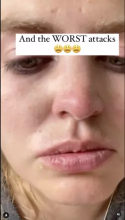 til-225.png til-225.png