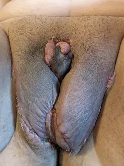 nsfl-for-bottom-surgery-stay-far-far-away-from-william-v0-8edrm23h39fe1.webp