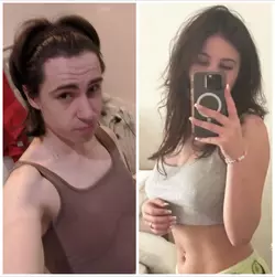 21yo-mtf-trans-post-op-3years-hrt-v0-ko852qpg93be1.webp