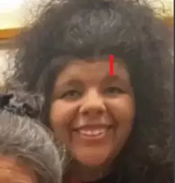 TophForehead.png