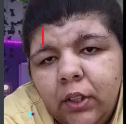 TophForehead02.png