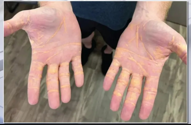 hand.jpg
