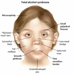 xke3ztod3iv71.webp