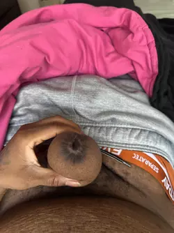 open-wound-on-tip-of-phallus-update-v0-d5ojbwffi9he1.webp