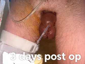 post-op-uk-nvh-mr-lee-v0-ntxrs39opcfe1.webp