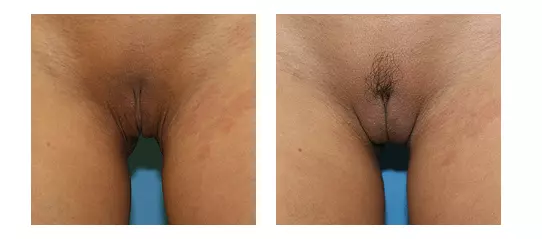 beforeafter.png