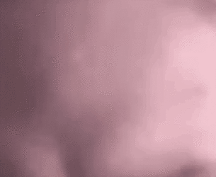 foreheadspider.gif