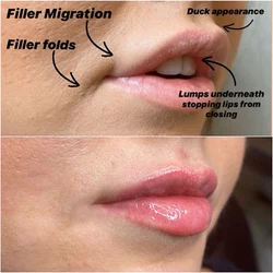 migrated-filler1.jpg