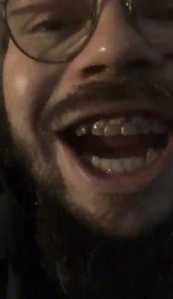 teef.jpg