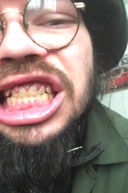 teef2.jpg