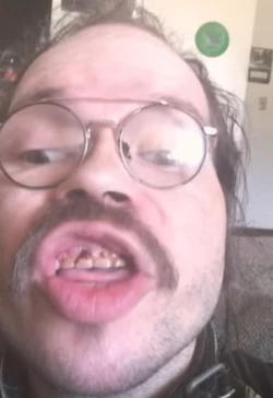 teef4.jpg