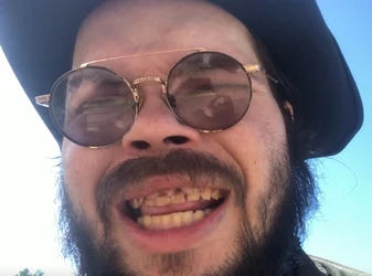 teeth4.jpg