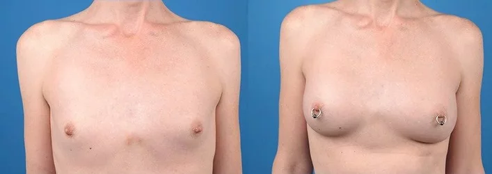 1657551227-mtf-melbourne-before-after(1).jpeg