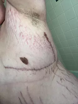 update-heart-nips-and-stretch-marks-galore-v0-7bvzo5g180je1.webp