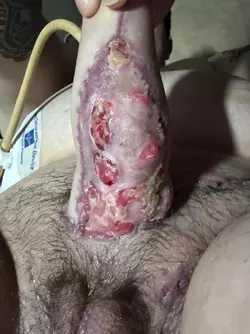 wound-separation-v0-ynto9jejugie1.webp