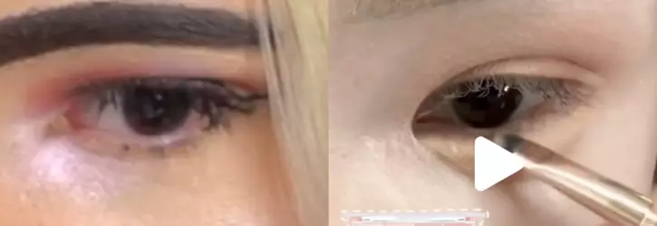 girl-gets-eye-procedures-to-look-more-asian-second-picture-v0-86lw9dqxa5le1.webp