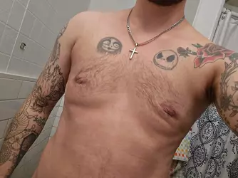 6-weeks-post-op-can-i-have-some-honest-opinions-on-my-v0-zuzxi40ei3me1.webp