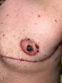 is-my-nipple-falling-off-v0-3j009ev8r1me1.webp