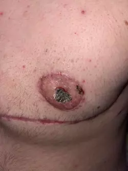 is-my-nipple-falling-off-v0-u23iwdv8r1me1.webp