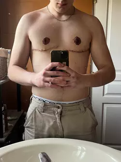 do-you-also-find-that-my-nipples-are-poorly-placed-v0-4ff9m7d6cple1.webp