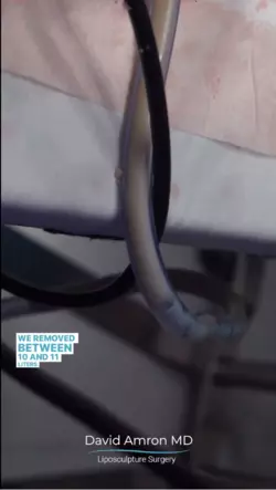 1741100805919.png