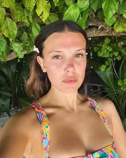 Acne.webp