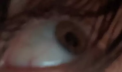 Terry's_eye.png
