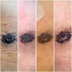 does-this-look-like-normal-healing-will-my-nipples-survive-v0-8h69ygquq5ne1.webp