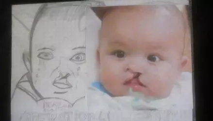 operation_smile_by_chancejamesfwilkins_dbs9vgu-fullview.jpg