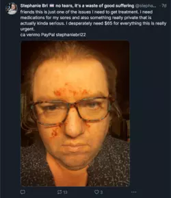 1741790872740.png