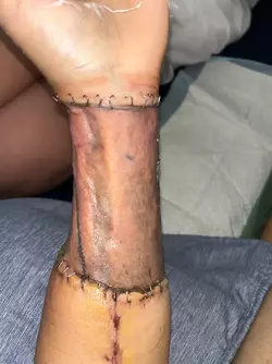 small-update-post-op-v0-y0n21knmiboe1.webp