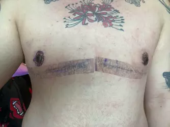 obligatory-do-my-nipples-look-okay-post-v0-32cqqzkwchoe1.webp