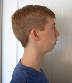jaw.jpeg