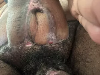swelling-post-op-concerns-v0-o6gw0ch3qwoe1.webp