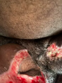 swelling-post-op-concerns-v0-h2vq7ch3qwoe1.webp