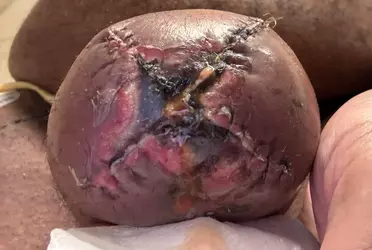 swelling-post-op-concerns-v0-beo26ch3qwoe1.webp