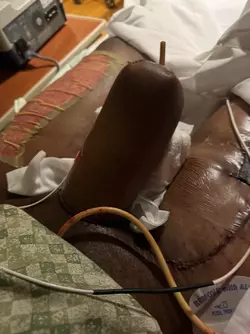 swelling-post-op-concerns-v0-tdl05ch3qwoe1.webp