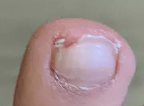 pain