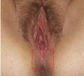The_male_and_female_perineum (1).jpg