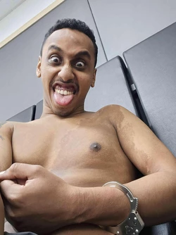 Aids Rash.jpeg
