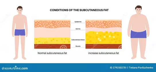 obesity-fat-level-conditions-subcutaneous-human-body-cellulite-concept-excess-insufficient-di...webp