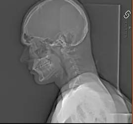 Clav Catscan.png